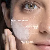 Effaclar Purifying Foaming Gel