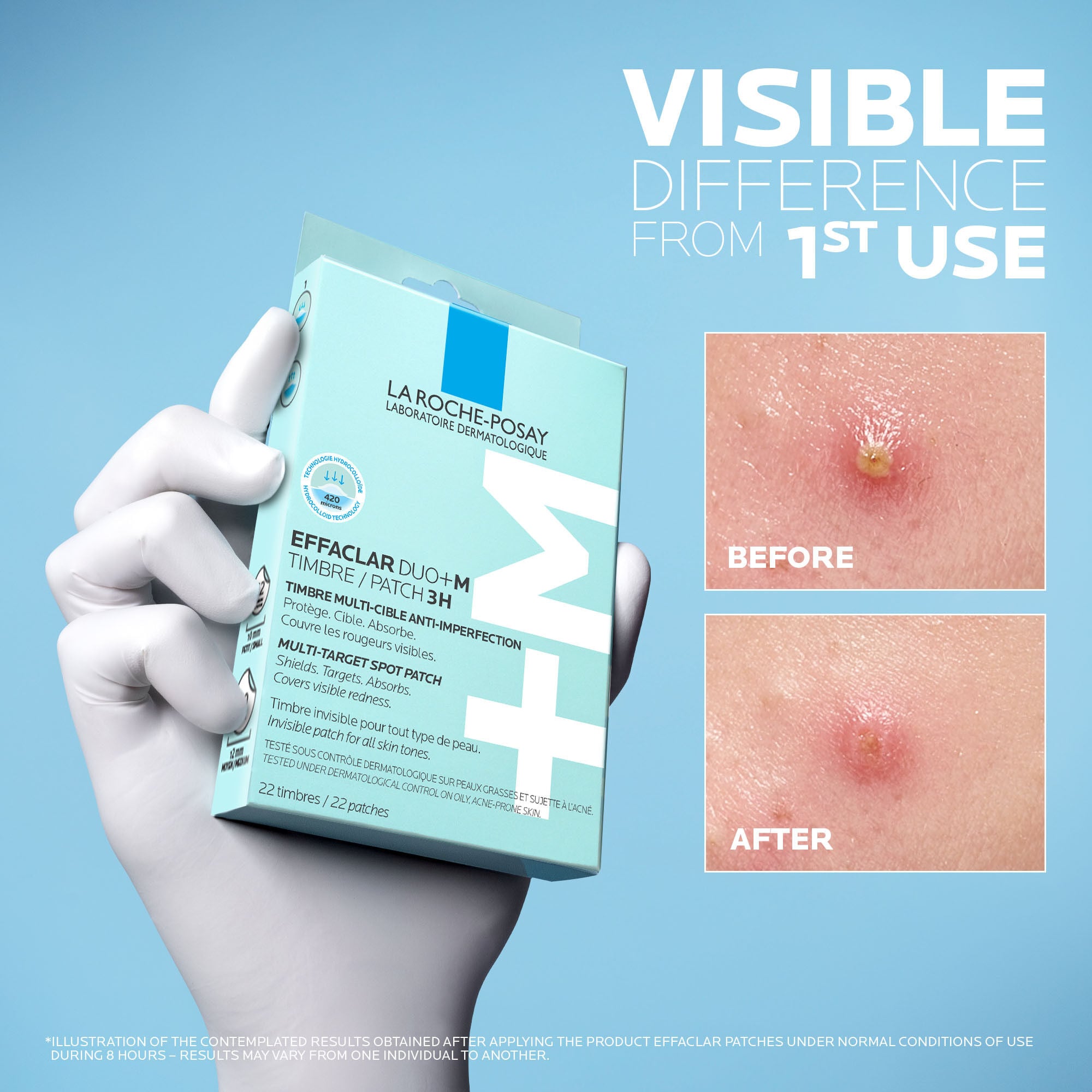 Effaclar Duo+M 3H Patches