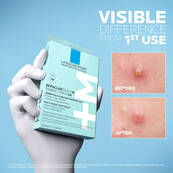 Effaclar Duo+M 3H Patches