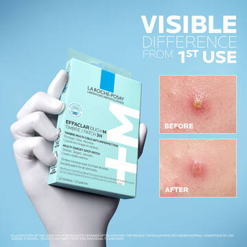 Effaclar Duo+M 3H Patches