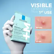 Effaclar Duo+M 3H Patches