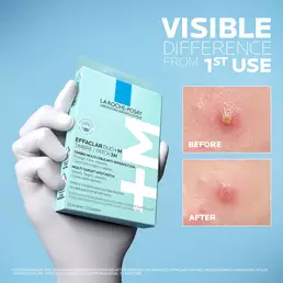 Effaclar Duo+M 3H Patches
