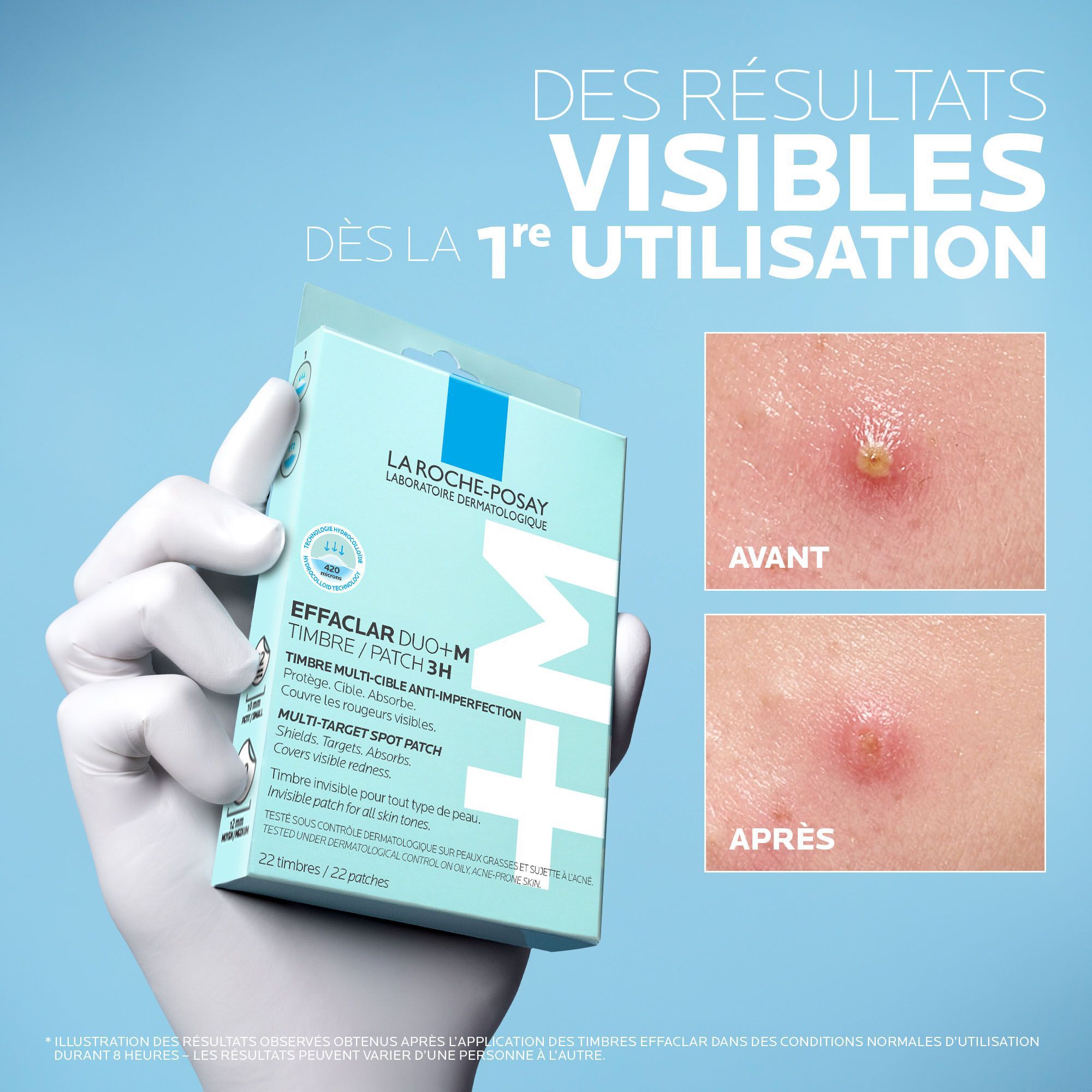Effaclar Duo+M Timbres 3H