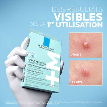 Effaclar Duo+M Timbres 3H