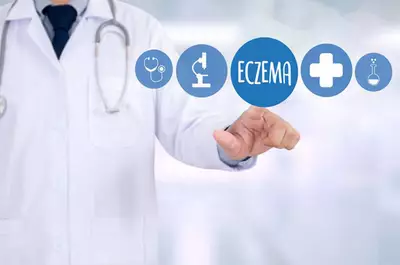 What causes eczema?