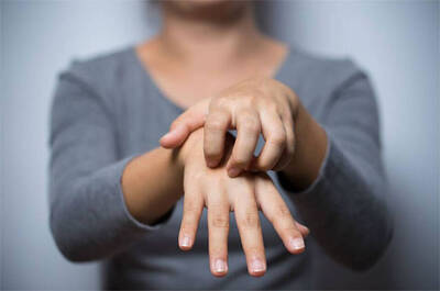 Comment prevenir l’eczema?