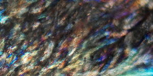 Sebulyse - An active ingredient more powerful than zinc, selected for its ability to inhibit sebum production at its source