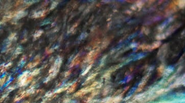 Sebulyse - An active ingredient more powerful than zinc, selected for its ability to inhibit sebum production at its source