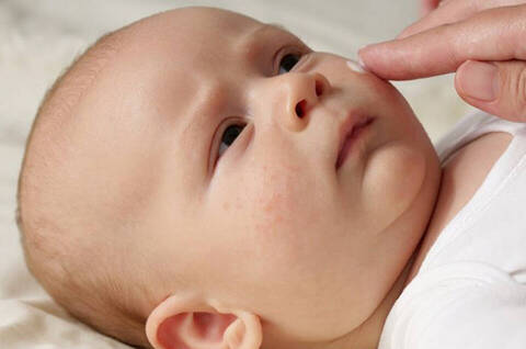 How to Relieve Your Baby s Eczema Prone Skin The Skin Edit