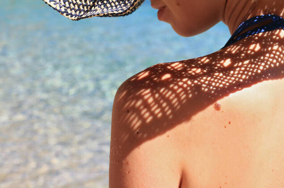 Les grains de beaute, le soleil et le cancer de la peau