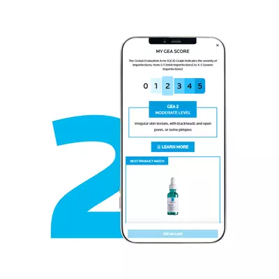 Smartphone screen displaying a skin analysis result with a moderate acne score and product recommendation for La Roche-Posay's skin care treatment.