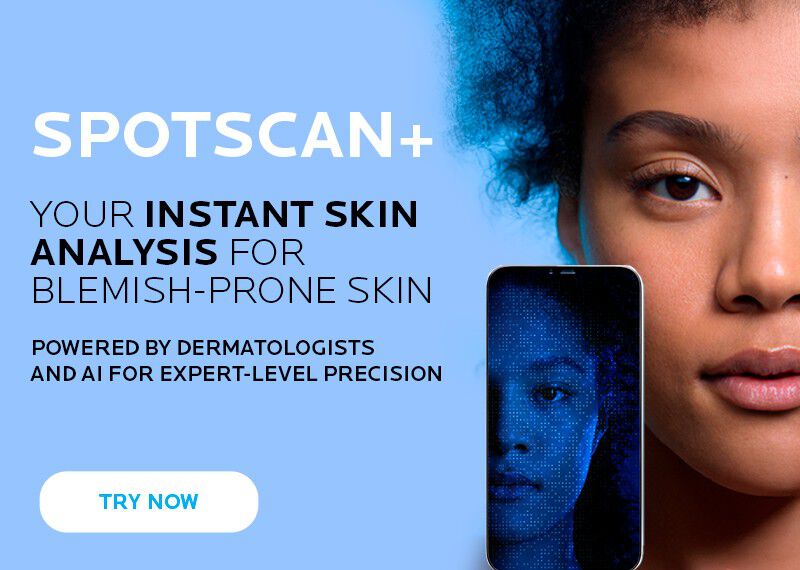 Half-face portrait of a young woman alongside her digital skin analysis on a smartphone, illustrating before and after skin condition. 