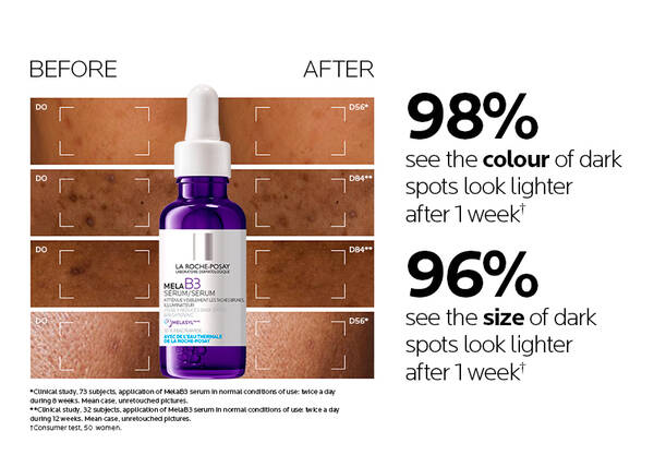 New Mela B3 Serum For Discoloration And Dark Spots La Roche Posay new-mela-b3-serum-for-discoloration-and-dark-spots-la-roche-posay