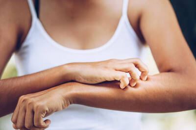 Peau sujette a l’eczema : traitements et astuces