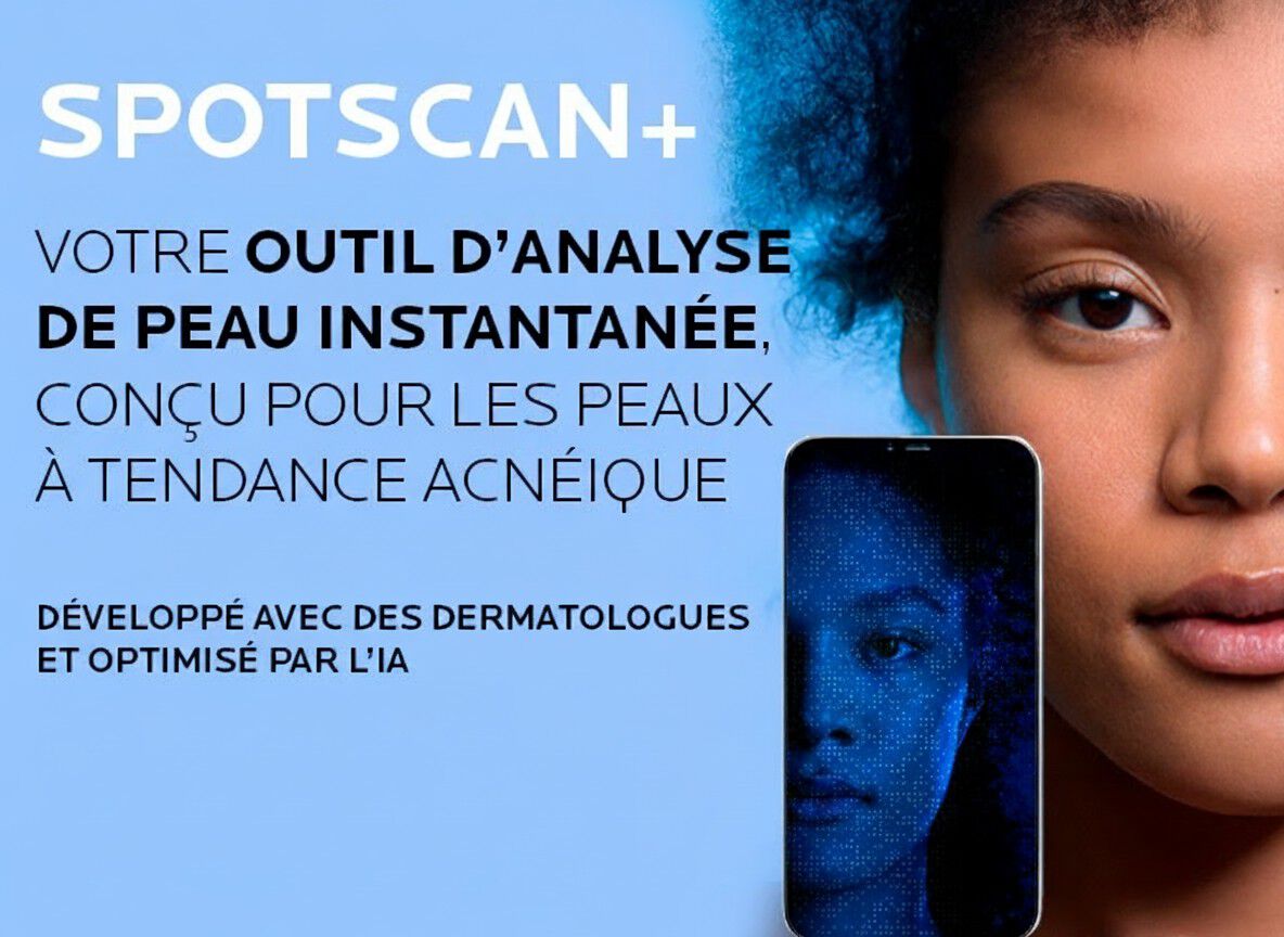 Portrait a demi-visage d'une jeune femme a cote de son analyse de peau numerique sur un smartphone, illustrant l'etat de la peau avant et apres.