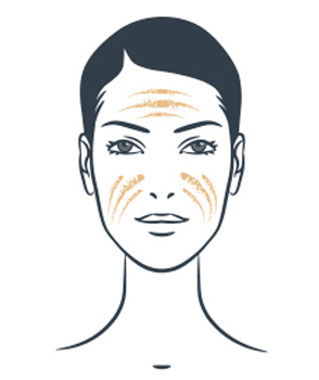 DRY SKIN