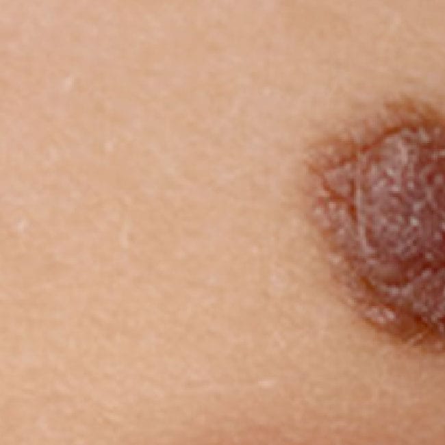 Skin Checker