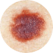 Border | Benign